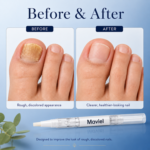 Maviel Antifungal Pen